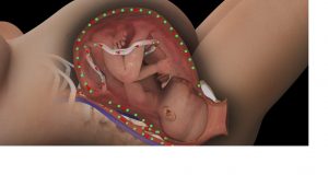 baby-in-womb-300x160